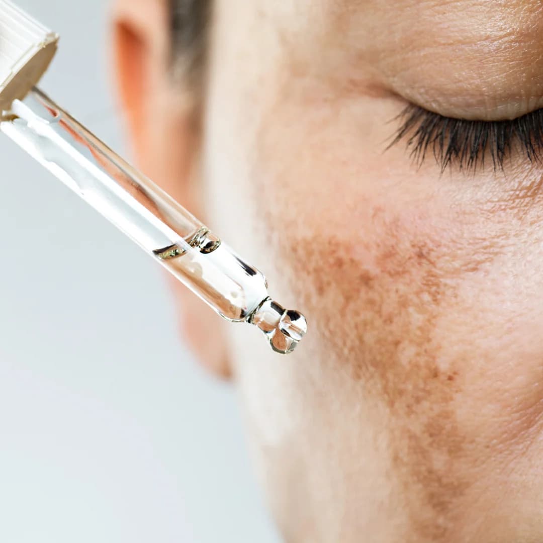 Acide Hyaluronique : Le Secret d'une Peau Repulpée